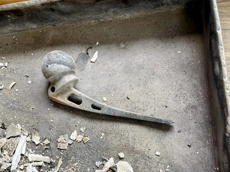 Prosthetic joint found in a crematorium