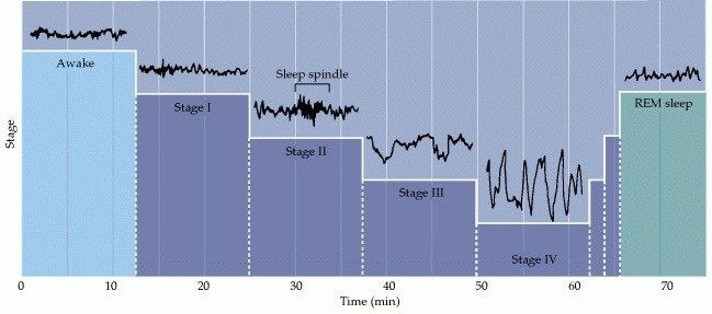 Brain activity during sleep stages