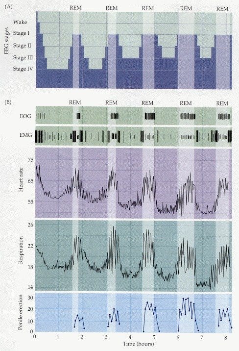 REM sleep characteristics