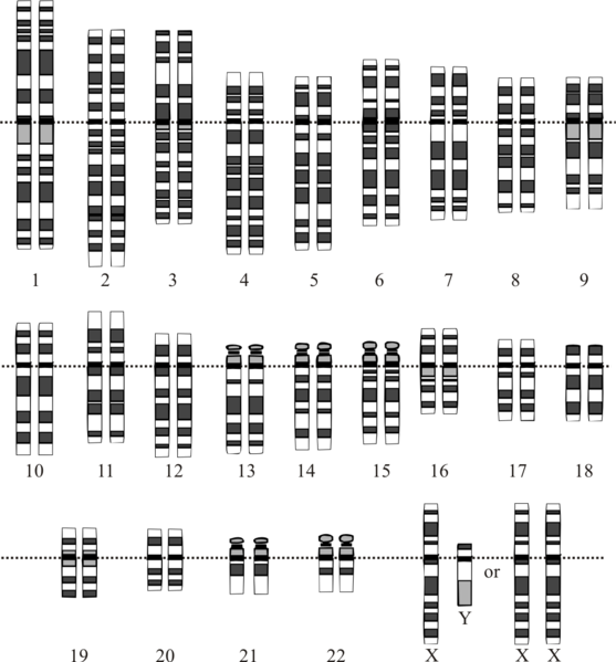 Image of human chromosomes