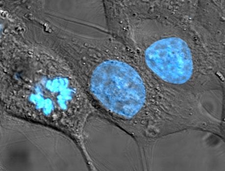 HeLa cells with Hoechst dye highlighting nuclear DNA