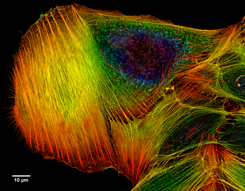 Z-projection of an osteosarcoma cell visualized with phalloidin