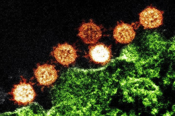 Visualization of the SARS virus, part of the coronavirus family.